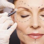 lipoestructura facial rejuvenecimiento Dr. Mario Secorun. Cirugía Plástica y Estética en Zaragoza