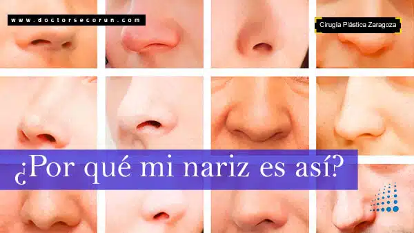 ¿Por qué es así mi nariz?