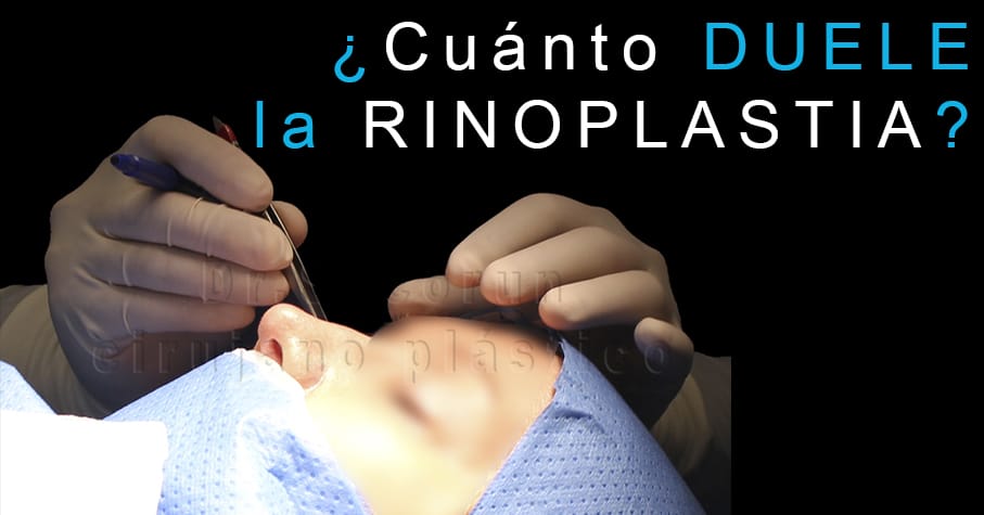 dolor rinoplastia