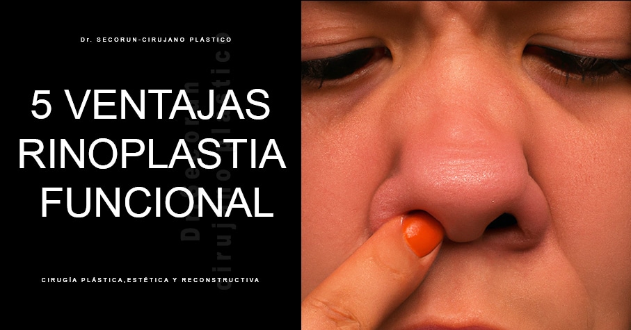ventajas rinoplastia funcional